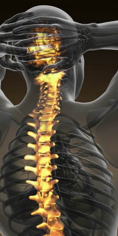 The Matai Miracle Spinal Healing: Decompression and spinal fusion are the two most common lumbar spine surgeries for patients with lower back pain and leg pain.